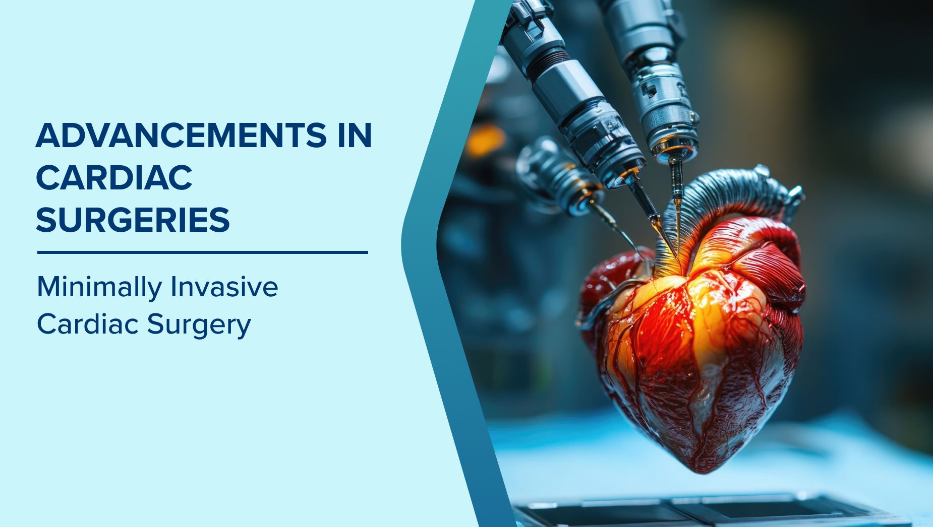 Advancements in Cardiac Surgeries: Minimally Invasive Cardiac Surgery